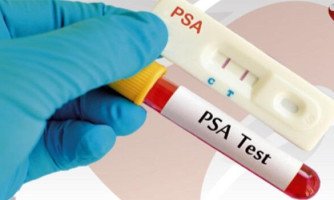 Testes rápido de PSA serão realizados no período de 26 a 28 de novembro em Araputanga