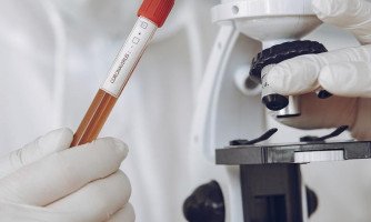 Aumenta os casos de Covid-19 em Araputanga; 57 confirmados