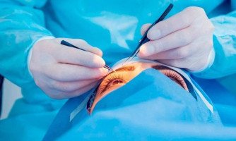 Cirurgia de retina poderá entrar na fila de “urgência” do sistema de regulação
