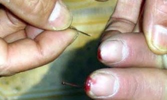 Jovem é resgatada pela Polícia Militar após ser torturada com agulhas pelo namorado