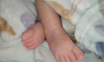 Internado há 8 meses, bebê que nasceu em Araputanga pode ter alta com ajuda de vakinha