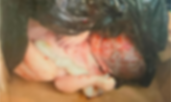 Recém-nascida com cordão umbilical é encontrada morta no lixo de condomínio em Mato Grosso